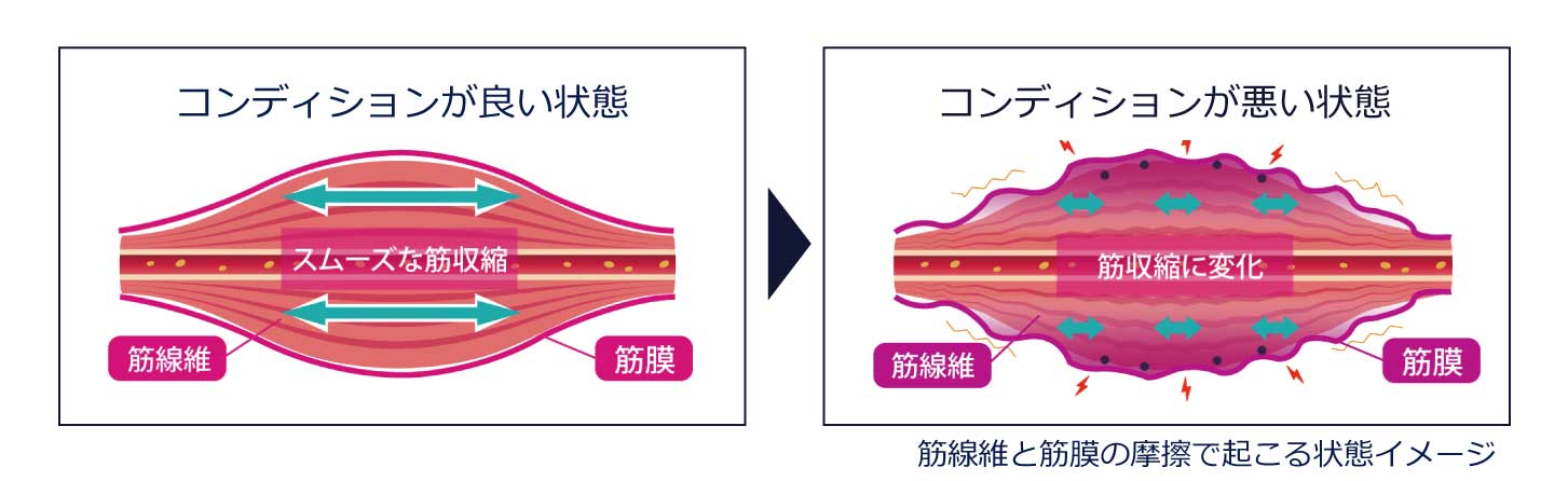 筋膜と筋原線維の摩擦イメージ